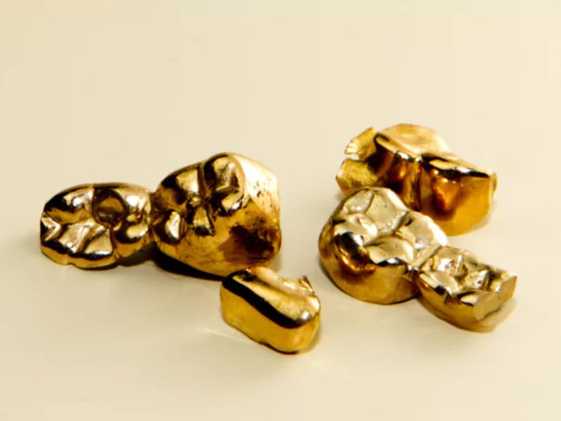 degussa-altgoldkampagne-zahngold